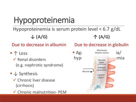 beta 1 globulin low|Low Protein in Blood (Hypoproteinemia) .